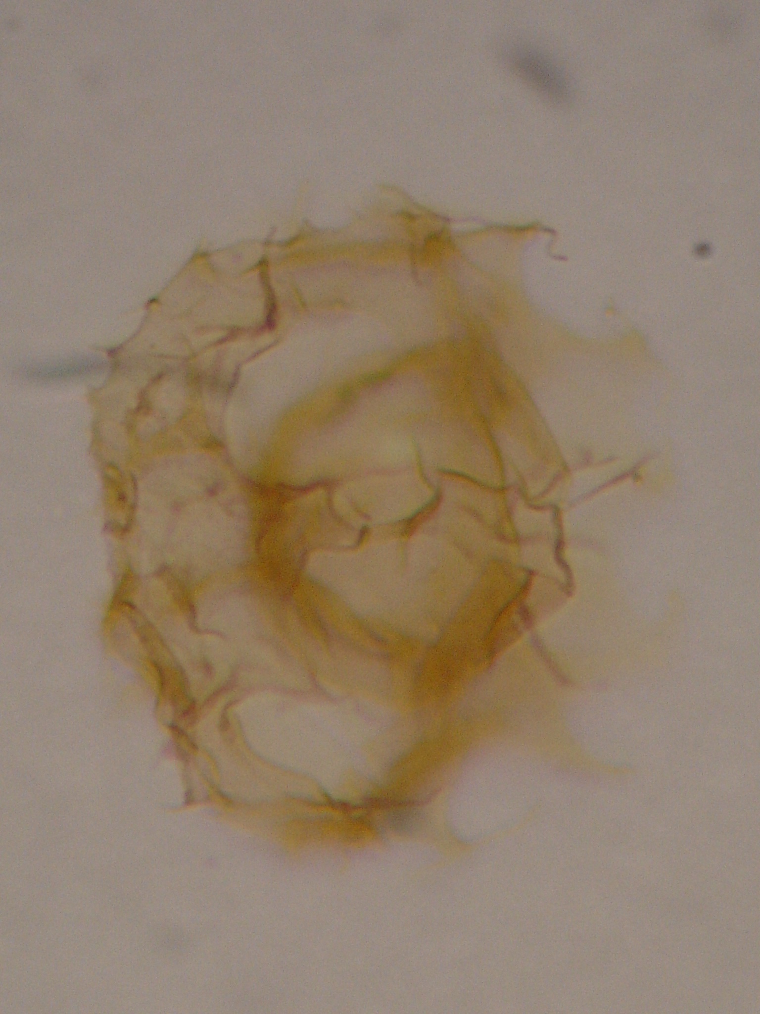 Hystrichostrogylon clausenii 2.JPG